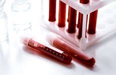 Others can be made by several types. Grail Inks Deal With Uk National Health Service To Offer Cancer Screening Blood Test In 2021 Genomeweb