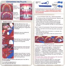 Great Information On Expanding The Palate From Practiceresources Net Palate Expander Orthodontics Palate