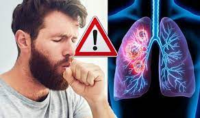 For instance, researchers hoping to reduce the risk of lung cancer in heavy smokers gave them beta carotene supplements. Lung Cancer Symptoms Signs Of A Tumour When You Cough Include Chest Pain Express Co Uk