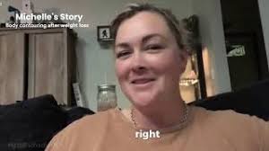 Dr. Fichadia Patient Stories