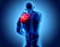 Esiste una lesione nota come cervicobrachialgia che si trova effettivamente nella cervicale i problemi cervicali e del collo influenzeranno la radice dei diversi nervi che attraversano il braccio e questa compressione causerà dolore al braccio sinistro e alla. Dolore Alla Spalla Da Cosa Dipende E Come Si Cura Crosystem