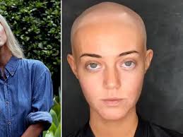 Lara Kitchen tomó la valiente decisión de mostrar su verdadero aspecto