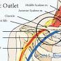 Thoracic outlet syndrome from www.hopkinsmedicine.org