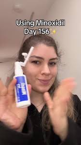 Hair Growth Journey with Minoxidil: Days 156-157 Updates