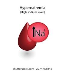 Image result for Hypernatremia