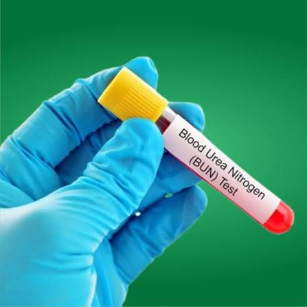 Serum Urea (BUN) Test: Evaluating Renal Function and Hydration