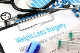 Weight Loss Surgery Uk Abroad Options Prices Nhs Before And After