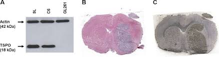 Altgriechisch ὄρχις orchis), fachsprachlich auch testis und testiculus, ist ein. A Expression Levels Of Tspo Measured In Protein Extracts From Rat And Download Scientific Diagram