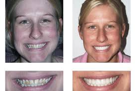 Lehigh Valley Smile Designs