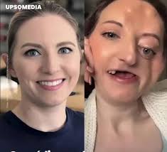 In 2017, Nicole Kowalski-Kleinsasser, a 25-year-old woman living in Nevada,  United States, started experiencing intense pain in her teeth and jaw that  hindered her from leading a normal life. Faced with the