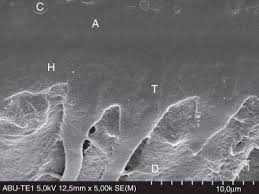 Looking for the ideal adhesive – A review - ScienceDirect