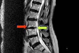 We did not find results for: Osteochondrose