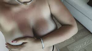 Wanda Nara stuns fans with sunburned boobs snap