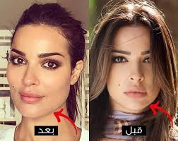 فاطمة الانصاري هي شابة سعودية وتبلغ من العمر 26 عام وهي غير متزوجة، وهي شقيقة خبيرة التجميل امل الانصاري، ولدت فاطمة الانصاري الكثير من الصور على مواقع التواصل الاجتماعي، وتعتبر فاطمة الانصاري من مشاهير سناب شات ولها الكثير من الصر الجميلة وباطلالات مكياج رائعة، وقد راج. Ù†Ø§Ø¯ÙŠÙ† Ù†Ø¬ÙŠÙ… Ù‚Ø¨Ù„ ÙˆØ¨Ø¹Ø¯ Ø¹Ù…Ù„ÙŠØ© Ø§Ù„ÙÙƒ