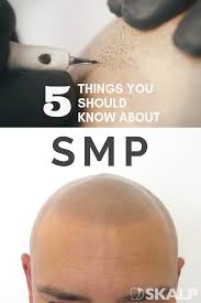 Scalp micropigmentation can be very effective for masking and hiding thinning hair. Pin On Hair
