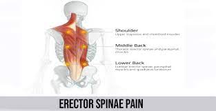 Pin On Human Body Pain