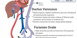 Image result for Delayed Transition from Fetal Circulation