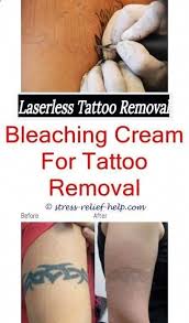 77 $50.00 coupon applied at checkout save $50.00 with coupon Black Ink Tattoo Removal