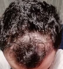 Zaten Aciliyordu 3 Ayda Daha Fena Oldu Resimli