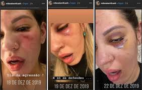 Este viernes, en horas de la noche, el ciclón le dio la bienvenida oficial al portero brasilero jean paulo fernandes filho, que ocupará el lugar que por lesión deja rodrigo muñoz. Sem Perdao A Jean Pela Agressao A Mulher Foi Para O Cerro Porteno Prisma R7 Cosme Rimoli