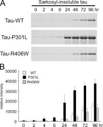 Japanese yen is sibdivided into 100 sen. Fibrillogenic Nuclei Composed Of P301l Mutant Tau Induce Elongation Of P301l Tau But Not Wild Type Tau Journal Of Biological Chemistry