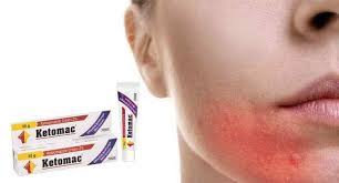 Jun 25, 2020 · ketoconazole 2% cream (nizoral cream by janssen, and others) is an antifungal medication used to treat various fungus and yeast infections. Antifungal Cream For Skin Infection Yeast Infection