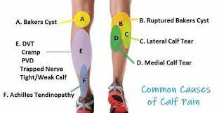 Calf Muscle Pain You Are Not Sure What Is Causing Your Calf Pain Check Out Calf Muscle Pain Is A Common Problem That Can Make Walking Running And Jumping Difficult And