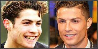 Биография футболиста криштиану роналду (cristiano ronaldo), фотографии из детства, молодости, ранних лет. Izvestnyj Futbolist Krishtianu Ronaldu Do I Posle Plastiki Leprekon