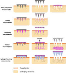 After your procedure, your medical provider may apply topicals to soothe, hydrate, and protect the treatment within the week following your microneedling procedure, you will notice skin dryness and flaking. Microneedles As The Technique Of Drug Delivery Enhancement In Diverse Organs And Tissues Sciencedirect