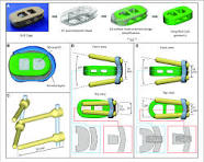 3D models of the implants. (A) Physical OLIF cage and ...