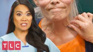Pimple popper is looking specifically for people with lipomas, cysts, large growths, undiagnosed skin conditions, or something oozing, draining, or bleeding. in the meantime, you can check out dr. Juliet Has Bumps All Over Her Chest And Neck Area Dr Pimple Popper Youtube