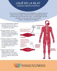 Fisiopatología, cuadro clínico, diagnóstico y tratamiento de ela. Qtbaq 5brvai3m