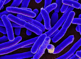 Is gbs a second cause of my uti? Scientists Create E Coli Bacteria With Completely Synthetic Genome Smart News Smithsonian Magazine