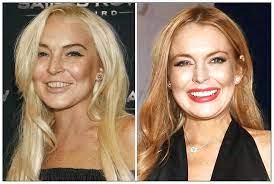 As the saying goes, eyes are the window to the soul, so it is important to keep them as sharp and clear as possible. Extraordinary Extreme Plastic Surgery Before And After Photo Session Plastic Surgery Fail Celebrity Plastic Surgery Extreme Plastic Surgery