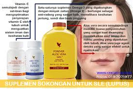 Penyakit november 2, 2014 0 angga. Punca Penyakit Sle Siapa Yang Berisiko Mendapat Sle Ohcantik Com