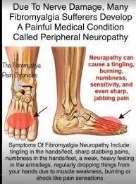 Pin By Jenny Savedbygraces On Health Fibromyalgia Causes Fibromyalgia Symptoms Peripheral Neuropathy