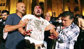 Georgian is the literary language for all regional subgroups of georgians, including those who speak the other kartvelian languages svan. Georgians Keep Protesting Despite Speaker S Resignation Washington Times