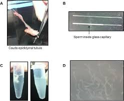 ماذا يحدث عند تناول السائل المنوي : Phosphopeptide Analysis Of Rodent Epididymal Spermatozoa Protocol Translated To Arabic