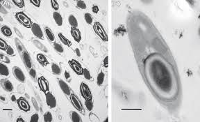 Image result for Cyperus breviradius