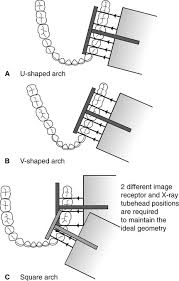 10 Bitewing Radiography Pocket Dentistry