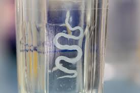 La plupart du temps, si la présence de vers intestinaux chez l'adulte et chez l'enfant est diagnostiquée, un traitement antiparasitaire ou vermifuge sera prescrit. Vers Intestinaux Diagnostic Pourquoi Docteur