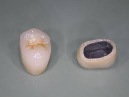 Pin By Hak Avetisyan On Zubnoj Dental Crowns Dental Teeth Health