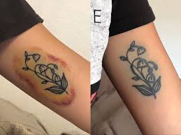 Check spelling or type a new query. My Inner Arm Tattoo 6 24 19 Vs Now What Happened And What Can I Do Tattoo