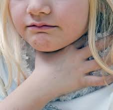 Sie sollten ihre mandeln daher nur entfernen lassen, wenn es wirklich. Wachter Des Immunsystems Wann Die Mandeln Raus Sollten Und Wann Nicht Welt