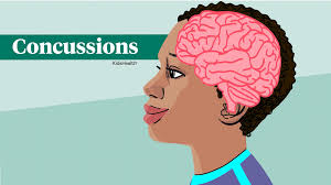 Image result for Concussion