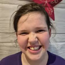 Epilepsy Society: Challenge 100 2025