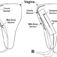 Don't be embarrassed to see a doctor if you can't find the tampon and/or can't seem to get it. Diagram Of Frozen Tampon Dissection Into 12 Pieces Download Scientific Diagram