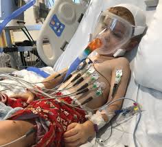 Image result for Difficult Intravenous Access in Children