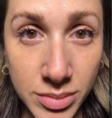 Dermatologist Dallas TX