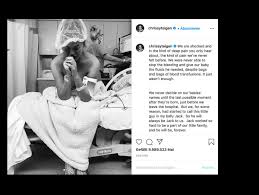 While many of the reactions to chrissy teigen's pregnancy loss announcement were kind and supportive, other last week, chrissy teigen and her husband, singer john legend, shared the. Chrissy Teigen Und John Legend Wie Sie Mit Dem Tod Ihres Sohns Umgehen Neue Bilder Der Trauer Der Spiegel